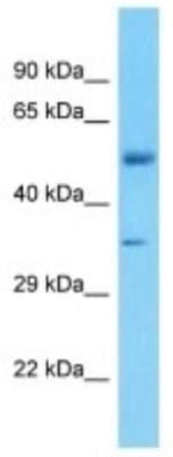 FBXO2 Rabbit anti-Human, Polyclonal, Novus Biologicals 25 &mu;g; Unconjugated:Antibodies,